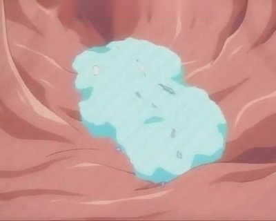 Wtf Is Happening Inside This Persons Stomach
