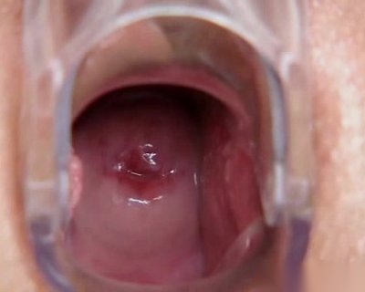 Exposed Blonds Barely Closed Vagina Exclusive-Club Uma Zex