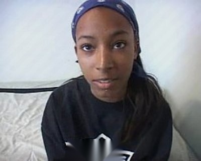 Pimps on the side of her face