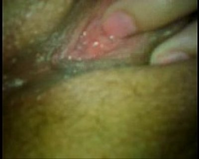 Fucked up pussy